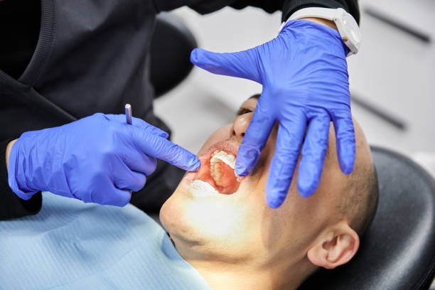 Best Emergency Treatment for Toothache in Woodlawn, VA